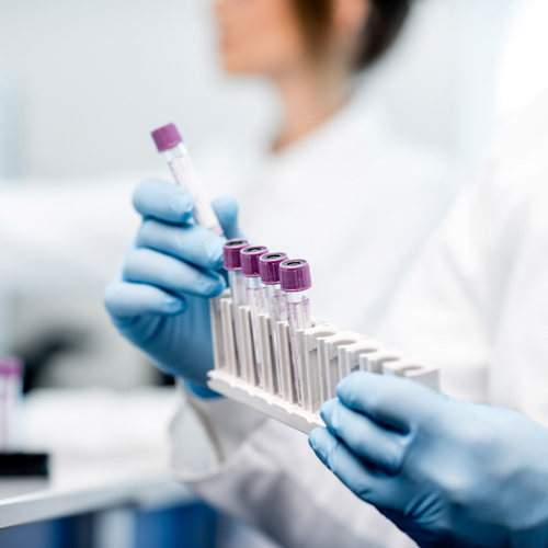 a row of lab specimens in test tubes