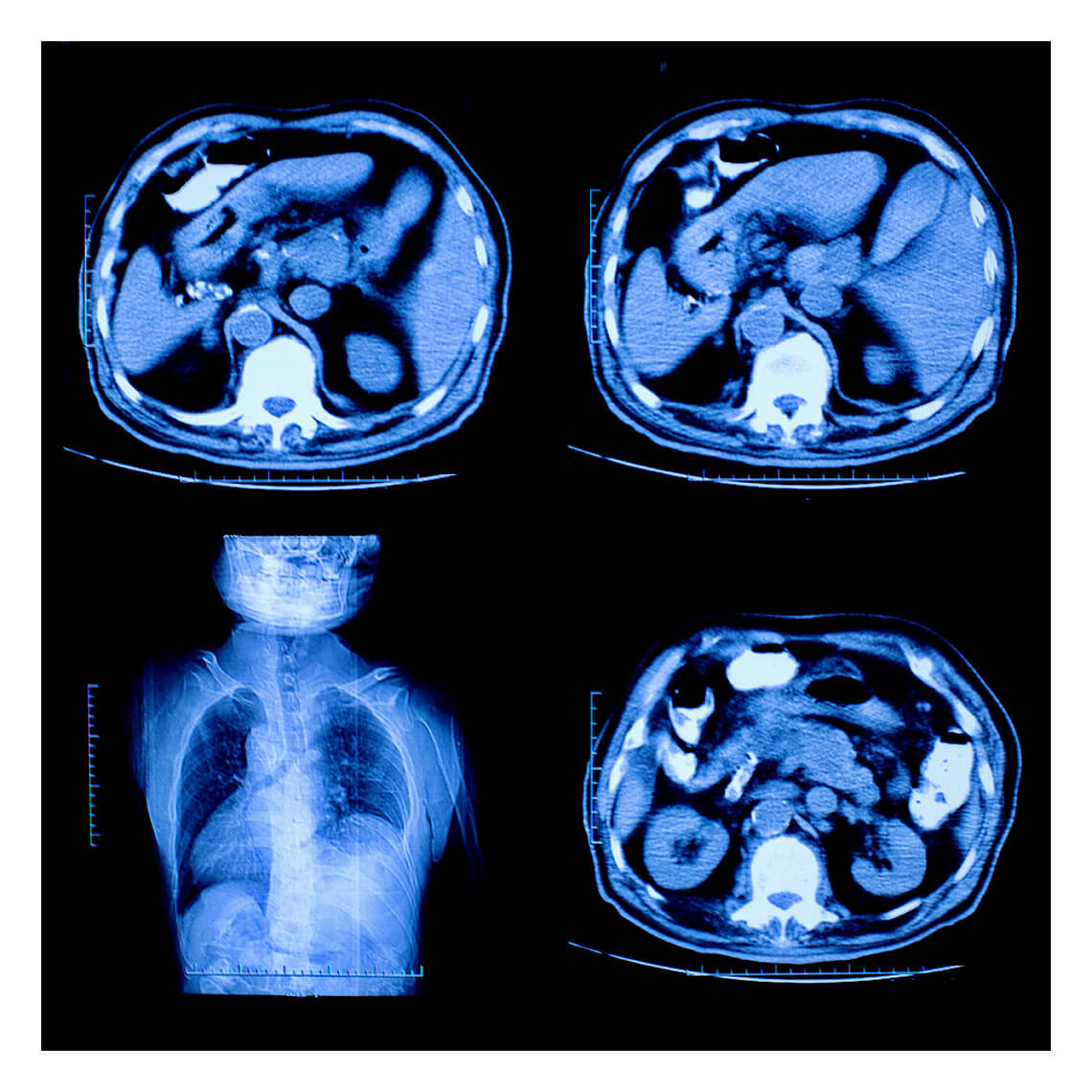 safety first radiology 1x1